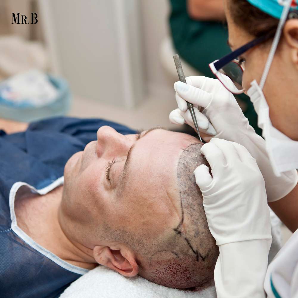 What is the Hair Transplant Cost in the US? | Mr. Business Magazine